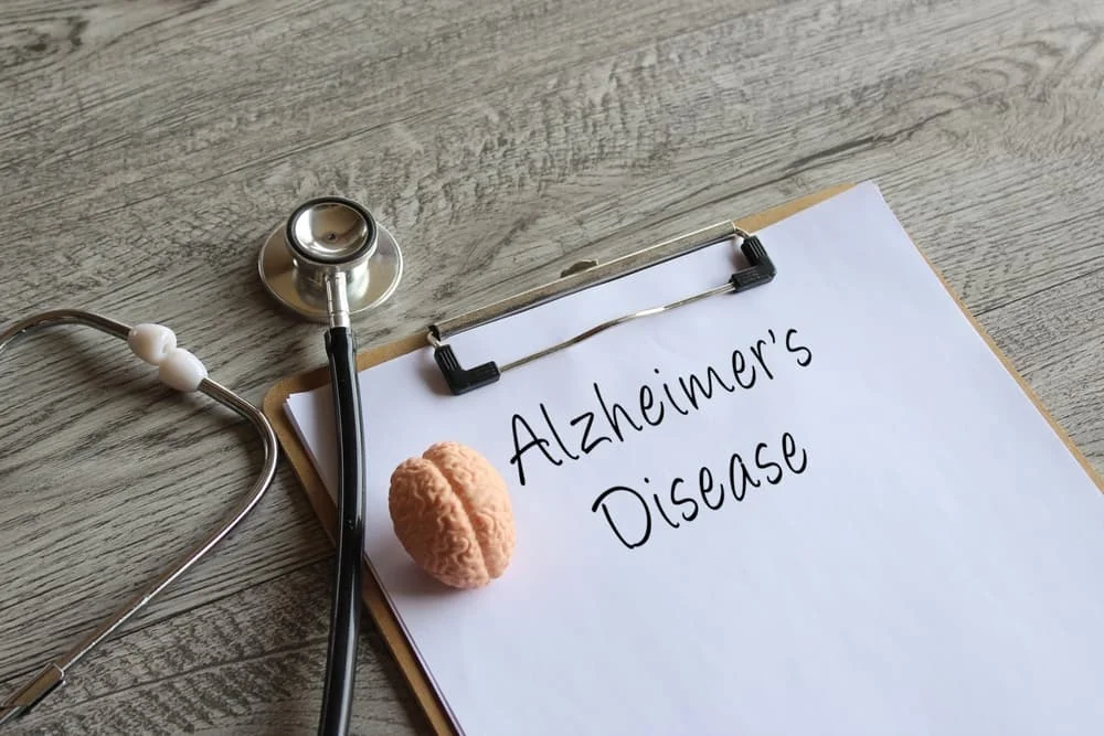 Stethoscope, human brain model and paper clipboard with text Alzheimer's Disease.